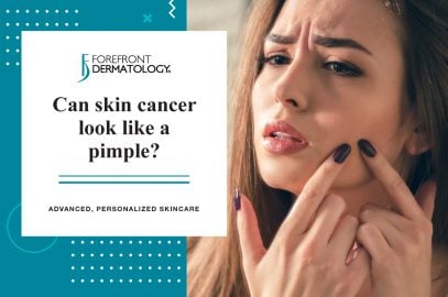 Can Skin Cancer Look like a Pimple? | Forefront Dermatology