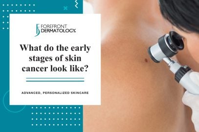 What Do The Early Stages of Skin Cancer Look Like? | Forefront Dermatology