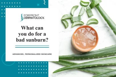 What Can You Do For A Bad Sunburn?