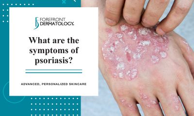 Symptoms of Psoriasis