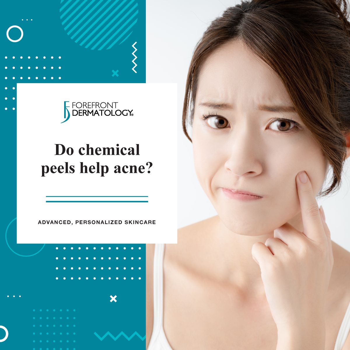 Do Chemical Peels Help Acne? - Forefront Dermatology