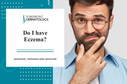 Do I Have Eczema?