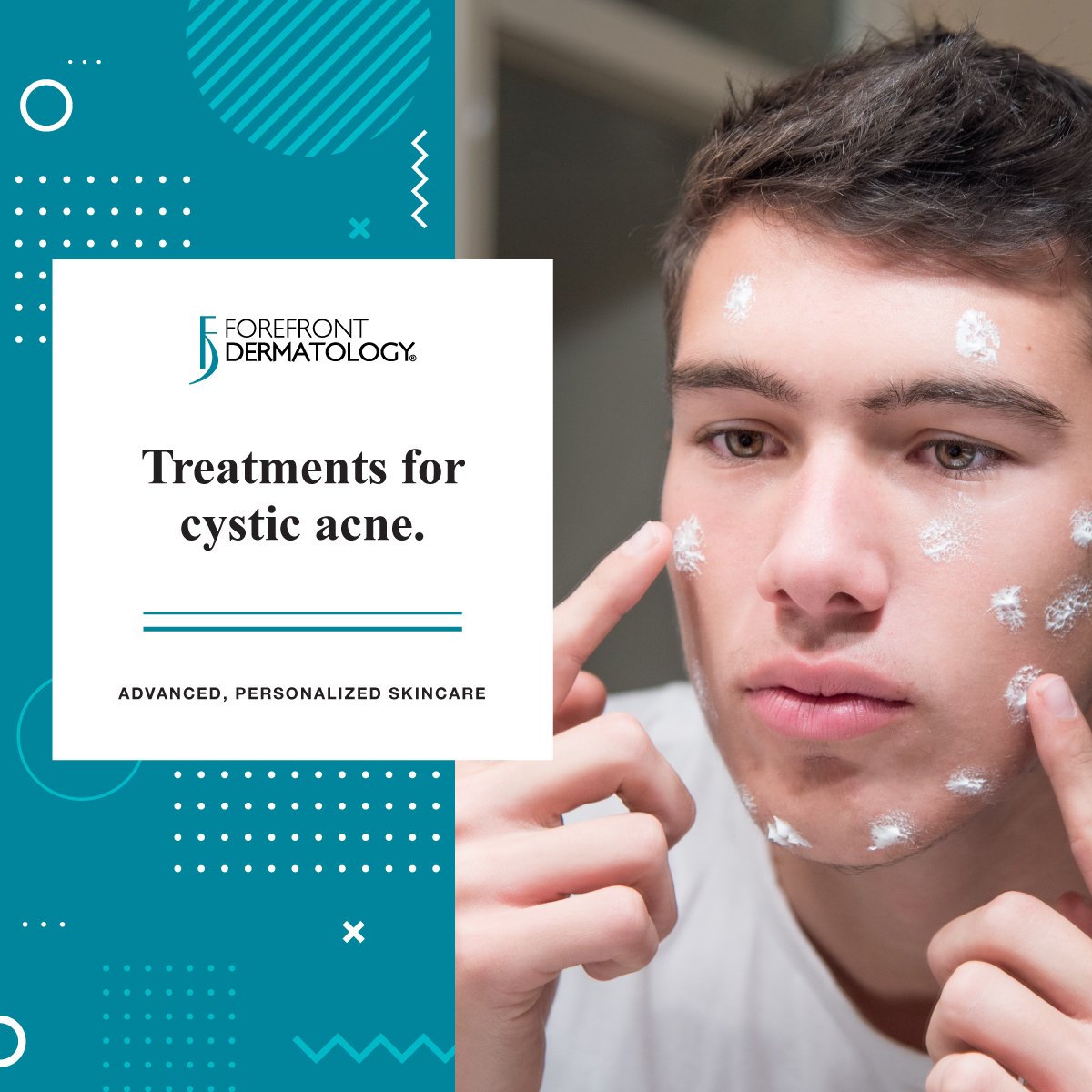 cystic acne pop