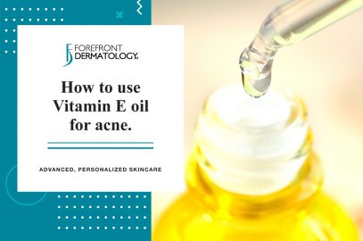 How to Use Vitamin E Oil for Acne