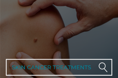 Skin Cancer Treatment Options