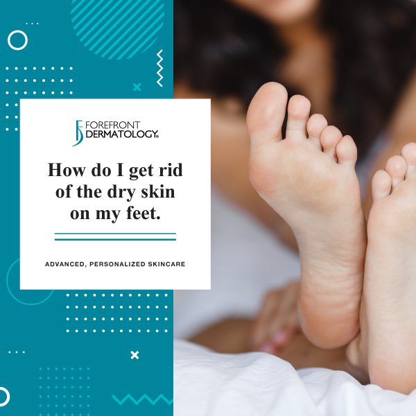 How to get rid of rough skin on feet