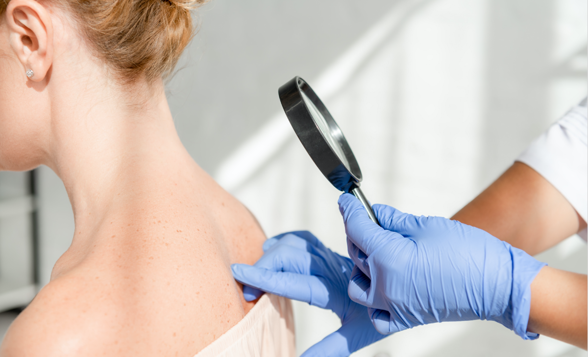 skin cancer treatment scottsburg in