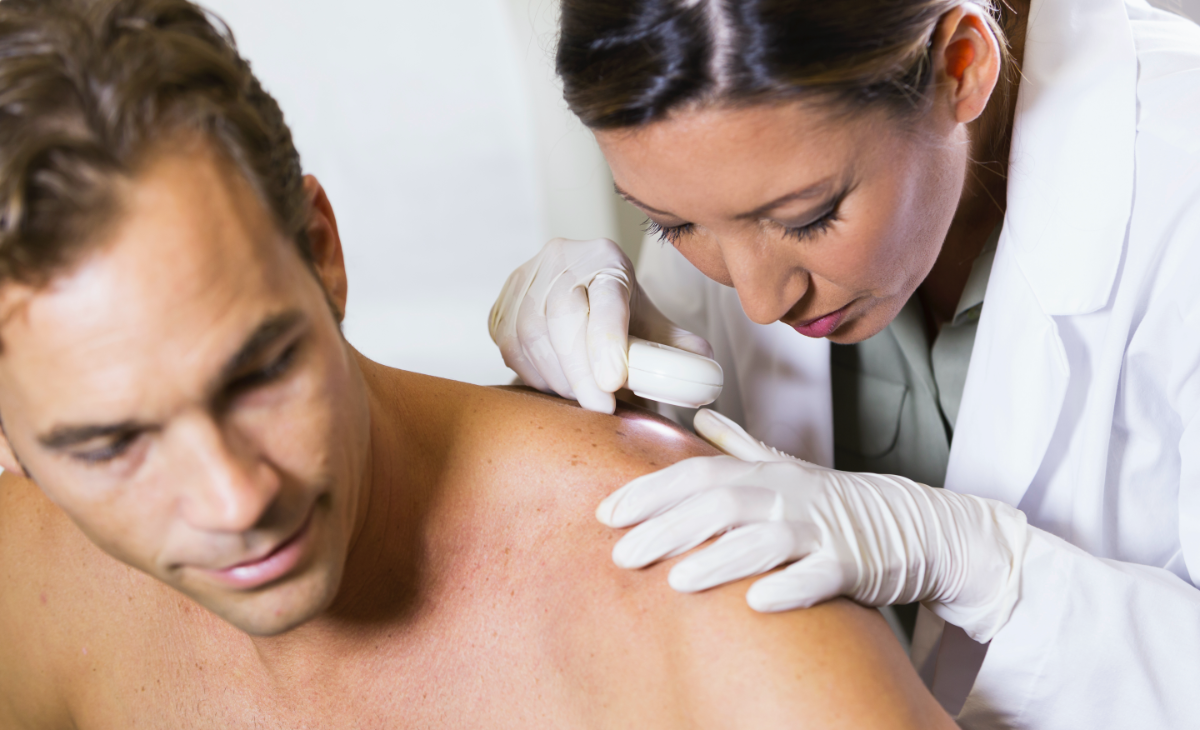 skin cancer screening