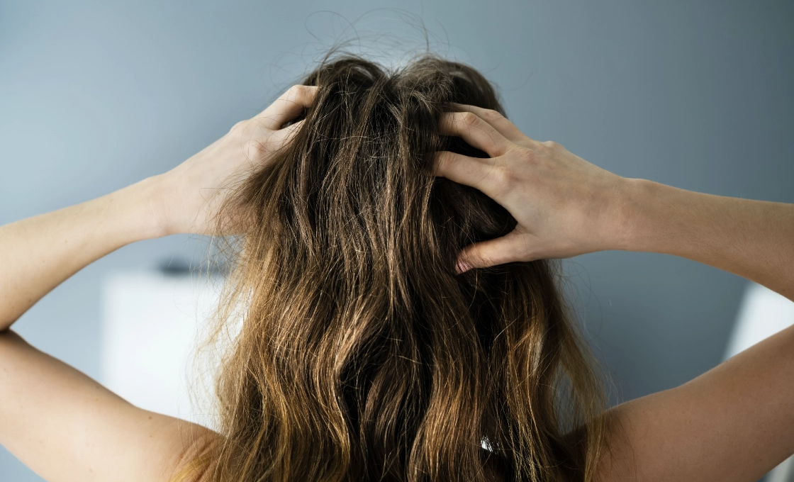 woman with dandruff