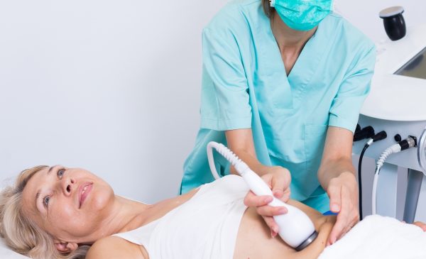 Is CoolSculpting Right for Me?