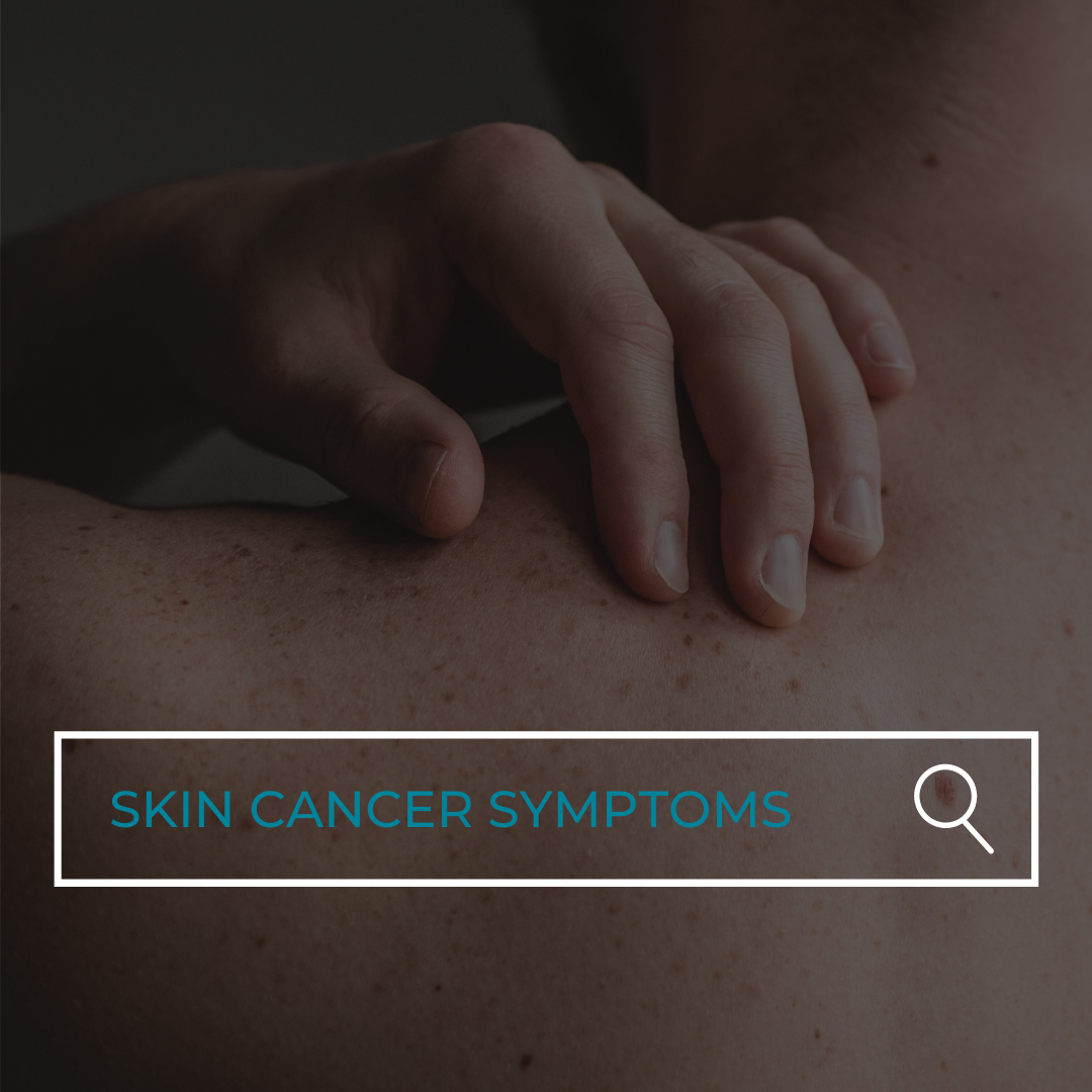 How Do You Know If You Have Skin Cancer Forefront Dermatology