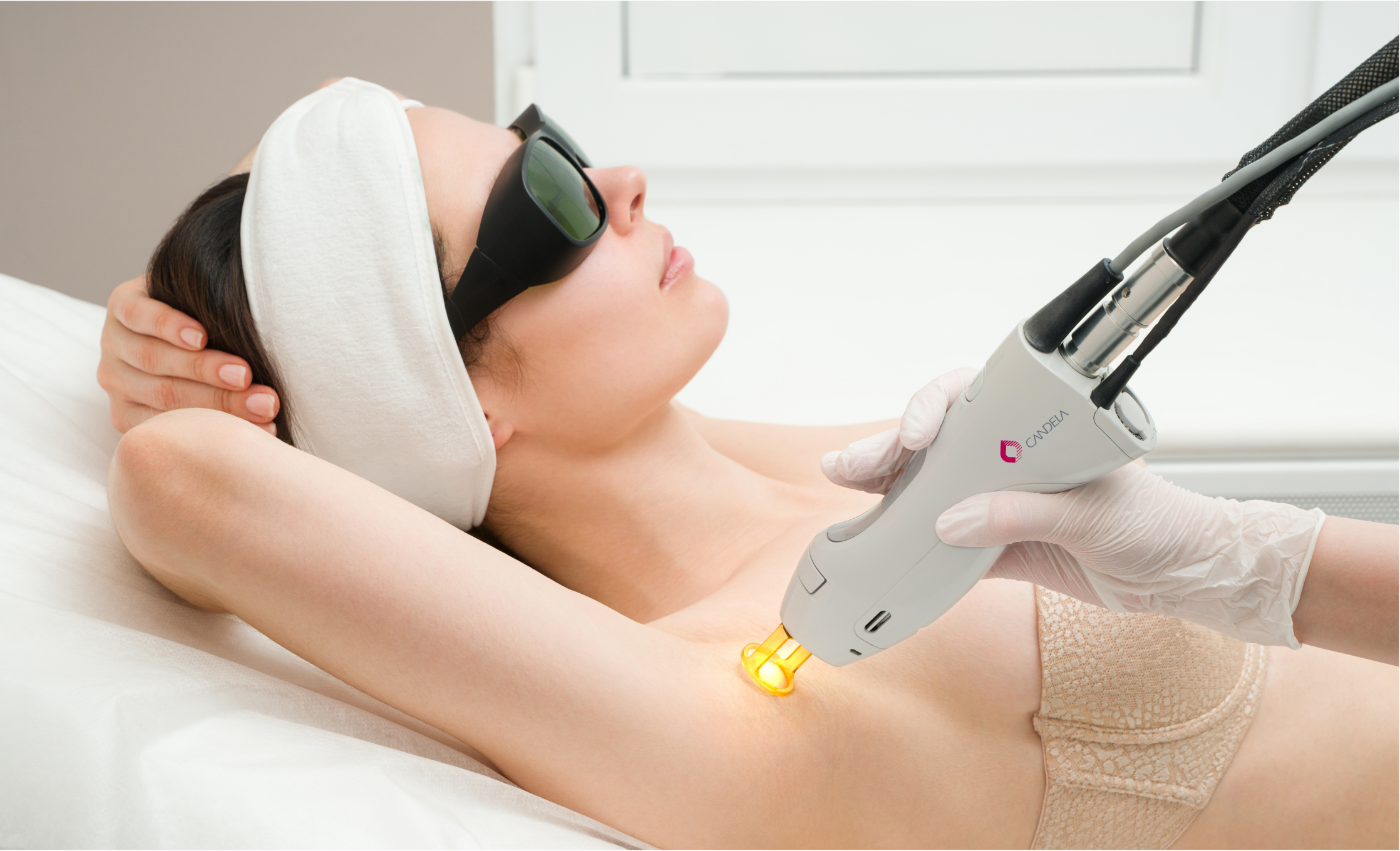 Candela GentleMax Pro Laser Treatment Options What is Candela