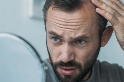 What Type of Doctor Can Help With Hair Loss?