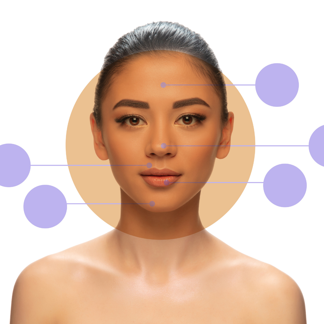 Acne Hack With Acne Mapping Forefront Dermatology 0692