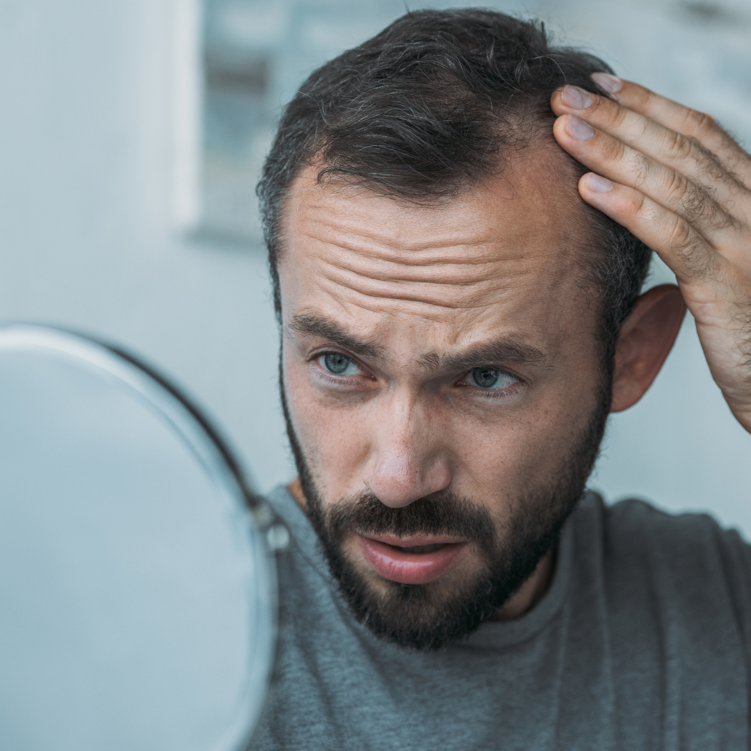 Understanding Hair Loss Options - Forefront Dermatology