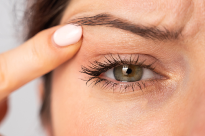 Is Eyelid Surgery Right for You?