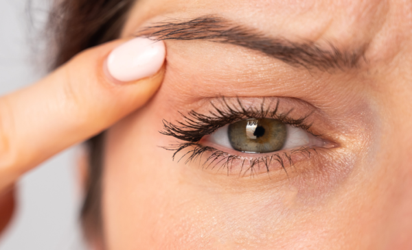 Is Eyelid Surgery Right for You?