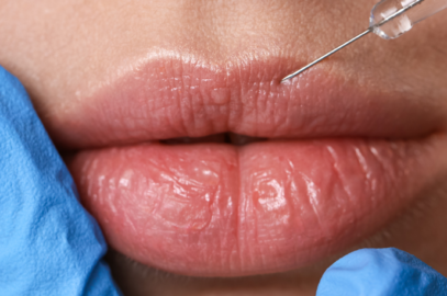 Pucker Up or Pass? The Ultimate Lip Flip Deep Dive