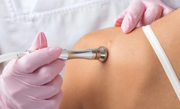 The Top 5 Aesthetic Treatments to Restore Your Look After Skin Cancer Treatment