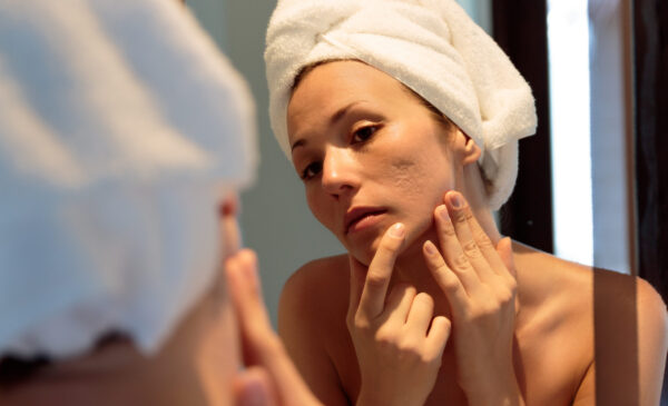 A Guide for Choosing the Best Facial Scar Treatment