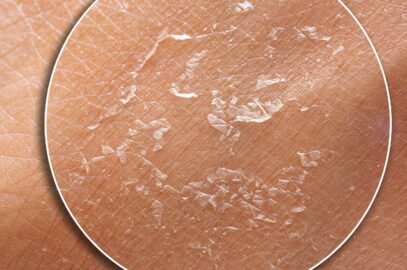 Is Your Skincare Routine Hurting Your Skin Barrier?
