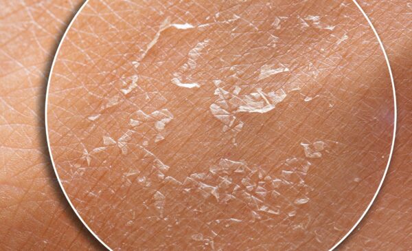 Is Your Skincare Routine Hurting Your Skin Barrier?
