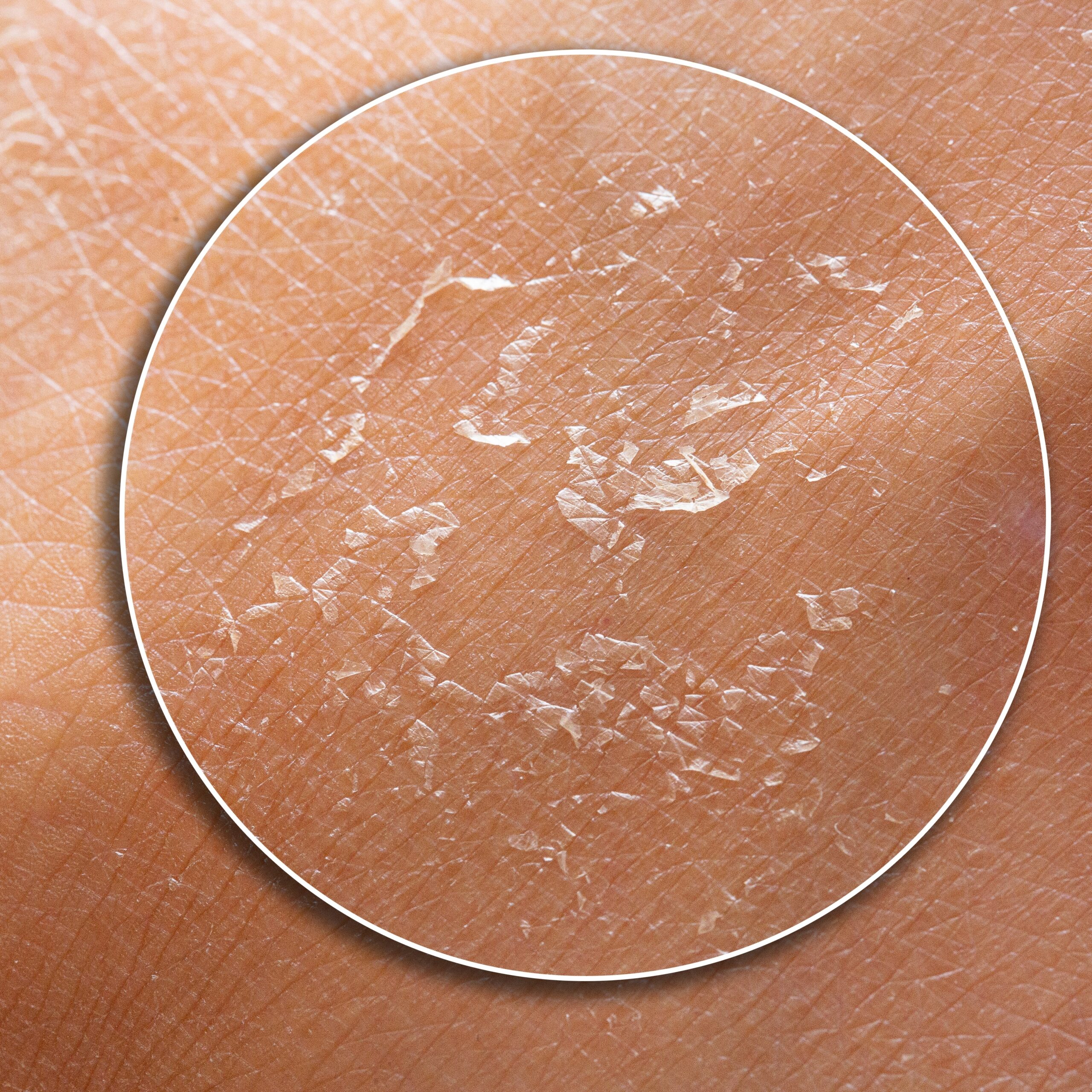 Is Your Skincare Routine Hurting Your Skin Barrier?