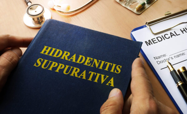 New Hope for Hidradenitis Suppurativa: Advancing Care with Compassion and Cutting-Edge Science