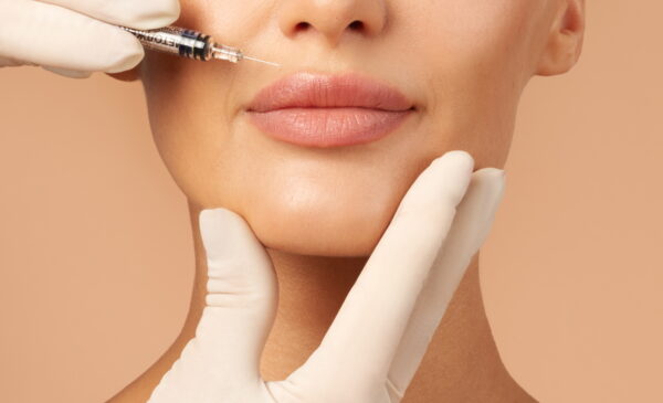 Enhancing Your Pout: What It’s Like To Get Lip Fillers