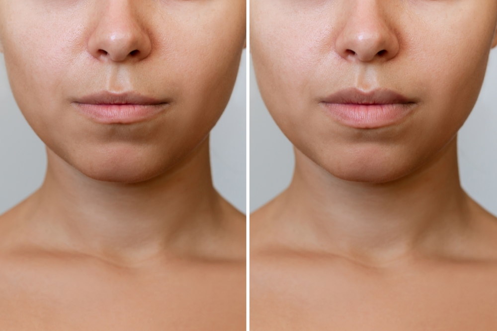 4 Signs You Might Be Over-treating Your Skin—and the Simple Routine to Save It